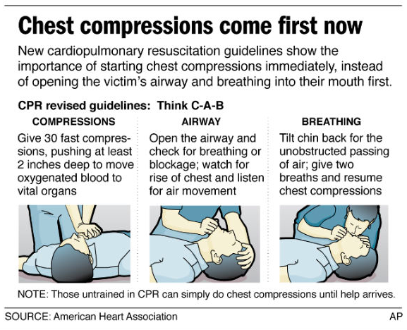 Learn CPR easily with the Beegees Stayin' Alive. Our kids are taught it in school, now it's your turn. It's not hard.